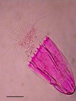 Light microscopy image of the undescribed species of Spinoloricus (Loricifera; stained with Rose Bengal). Scale bar is 50 μm.